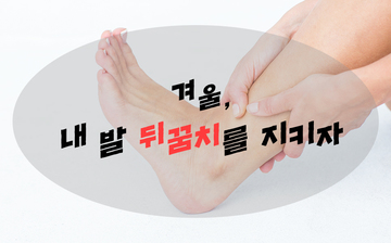 겨울, 내 발 뒤꿈치를 지키자